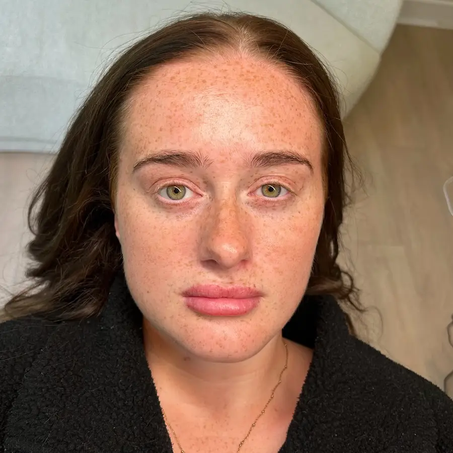 Before lash lift at Kovara