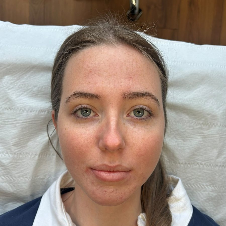 Before traditional lash lift at Kovara