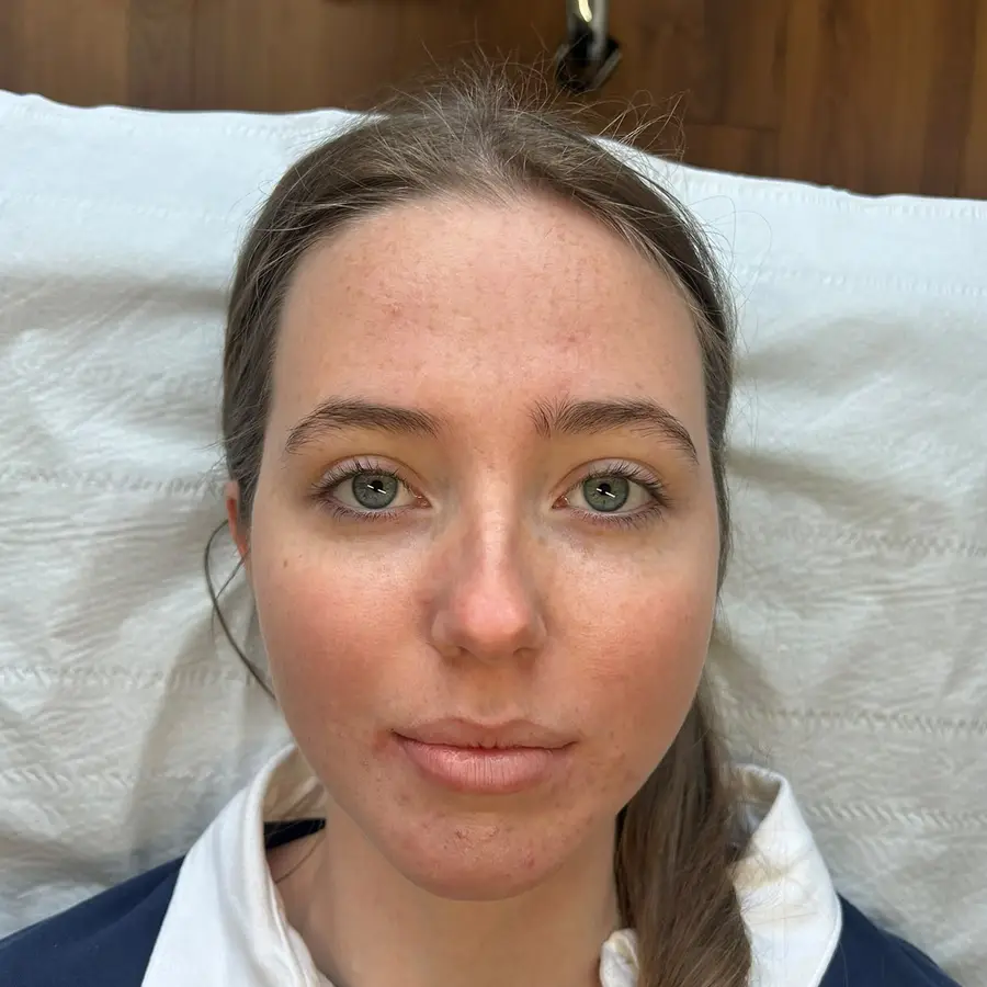 Before traditional lash lift at Kovara