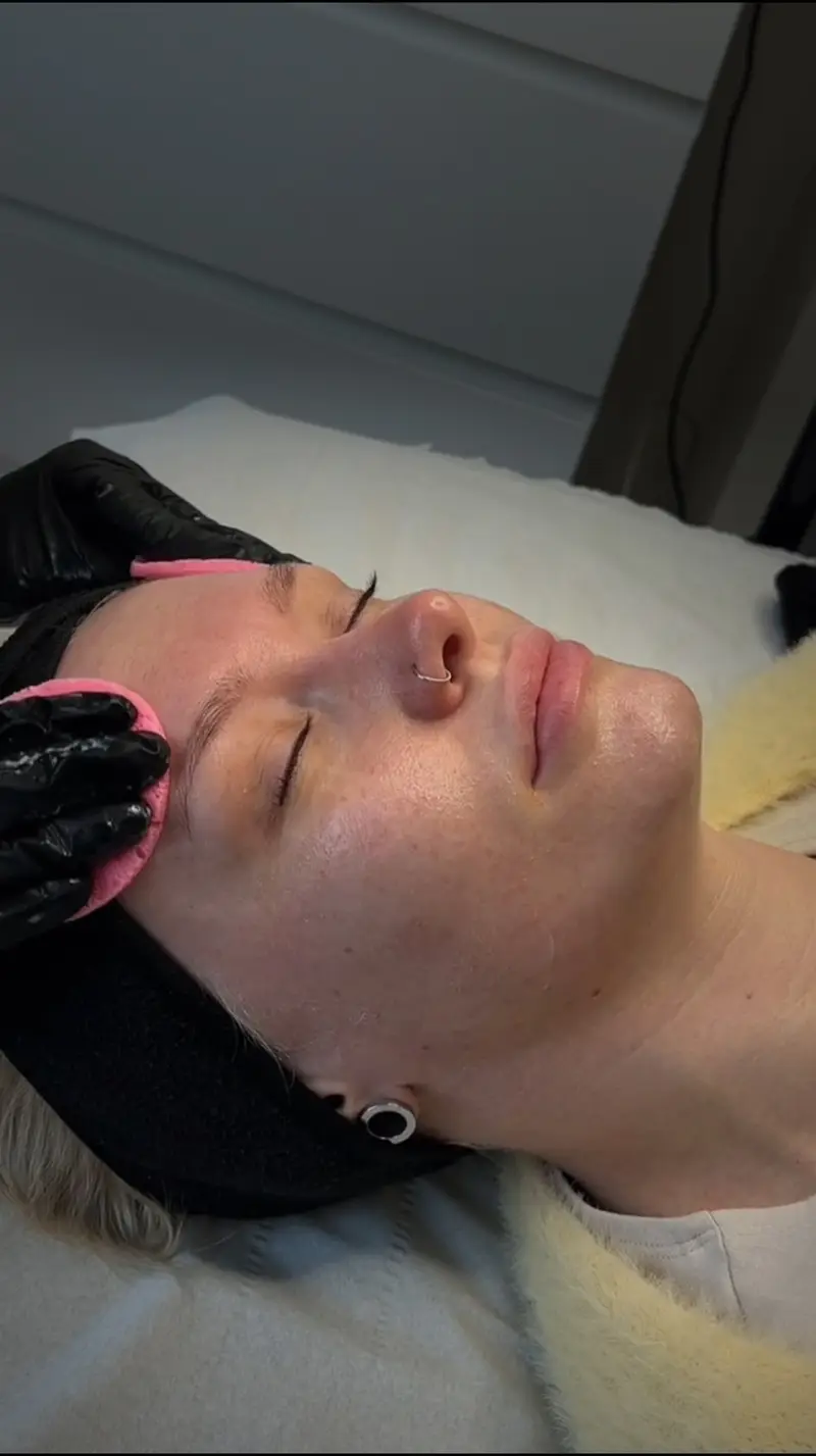 Close-up skin treatment at Kovara